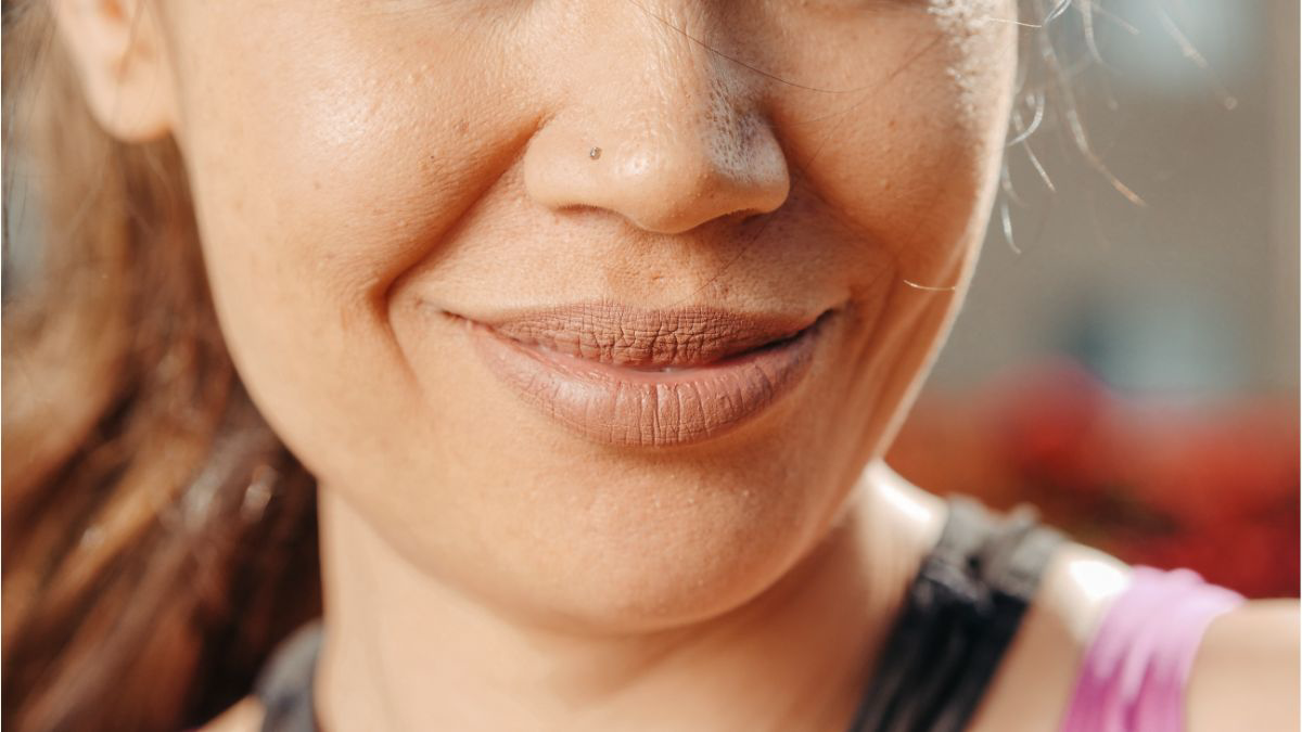 Cara Mengatasi Kerutan di Sekitar Mulut