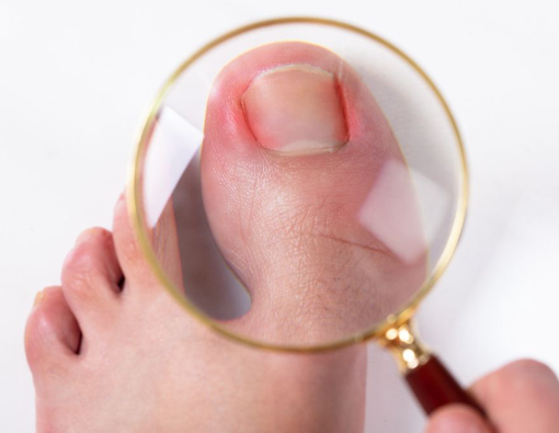 Penyebab Jempol Kaki Sakit dan Cara Mengatasinya