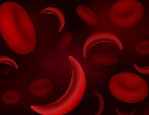Penyakit Sickle Cell Anemia, Apa Itu?