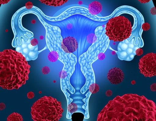 Skrining Kanker Serviks: 'Berdua' Lebih Baik daripada 'Sendiri'