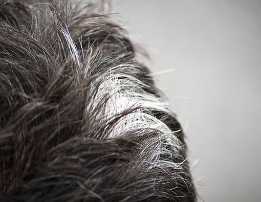 Belum Tua Kok Sudah Beruban?