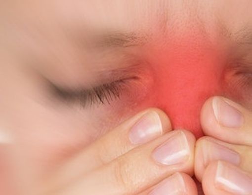 Kenali Lebih Jauh Soal Infeksi Sinus dan Asma