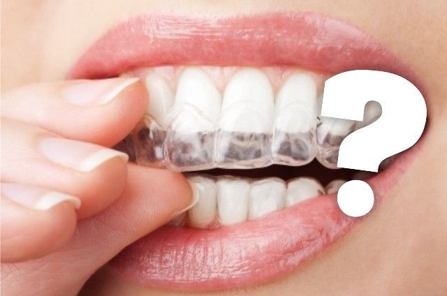 Apakah Memutihkan gigi Berisiko Bagi Gigi Sensitif?