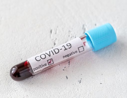 Benarkah Faktor Genetik Pengaruhi Keparahan Gejala COVID-19?