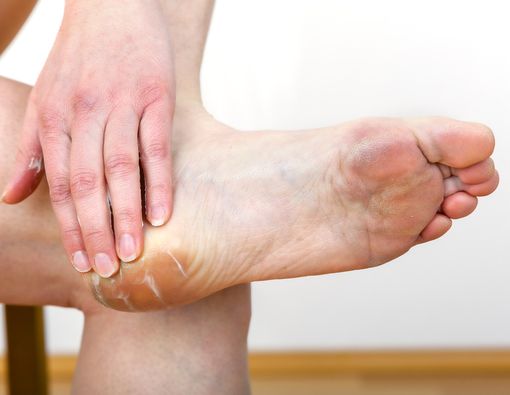 Kulit Telapak Kaki Robek pada Atlet, Apa Penyebabnya?