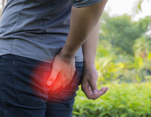 Hindari Wasir dengan Gaya Hidup yang Sehat