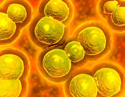 Mengenal Infeksi Chlamydia