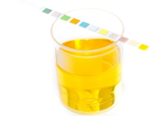 Mengenal Jenis-Jenis Inkontinensia Urine dan Gejalanya