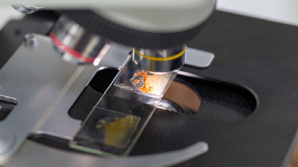 Awas! Ini Bahaya Memakan Kotoran Manusia