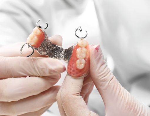 10 Hal yang Bisa Bikin Rusak Gigi Palsu