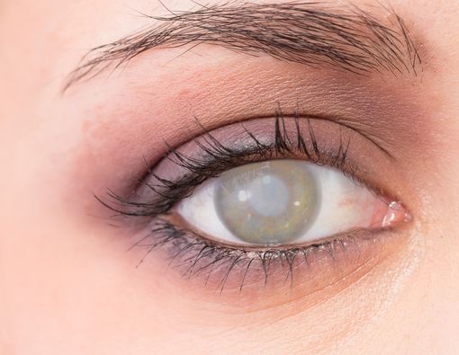 Kapan Operasi Katarak Harus Dilakukan?