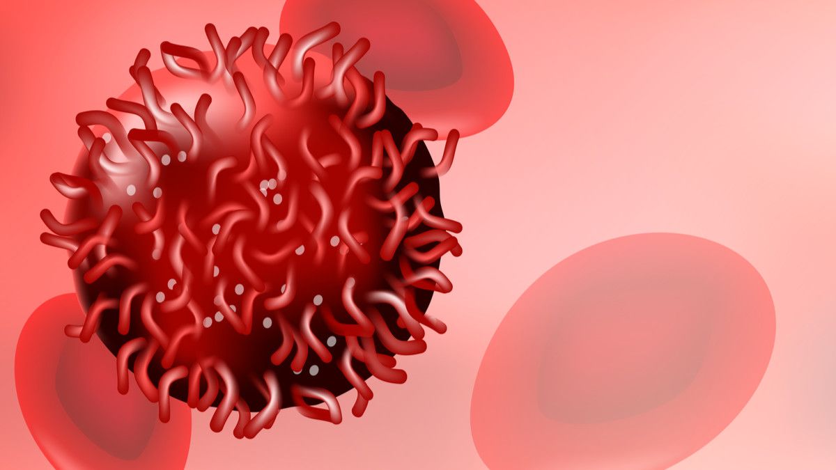 Waspada Kanker Darah Saat Anemia Berkepanjangan