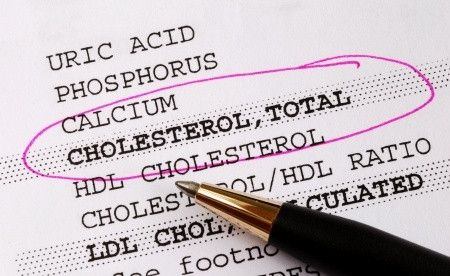 Cara Membaca Hasil Pemeriksaan Kolesterol