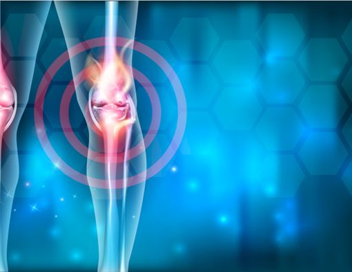 Penyebab Artritis yang Sering Diabaikan