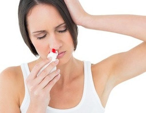 Mimisan? Jangan Sembarangan Mendongak!