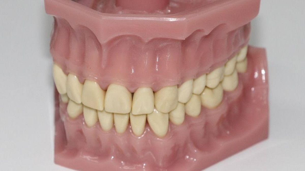 Penyebab Gigi Berwarna Abu-abu