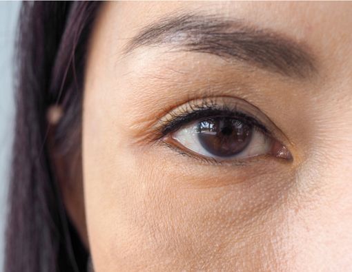 Mengenal Sifilis Okuler, Sifilis yang Terjadi pada Mata