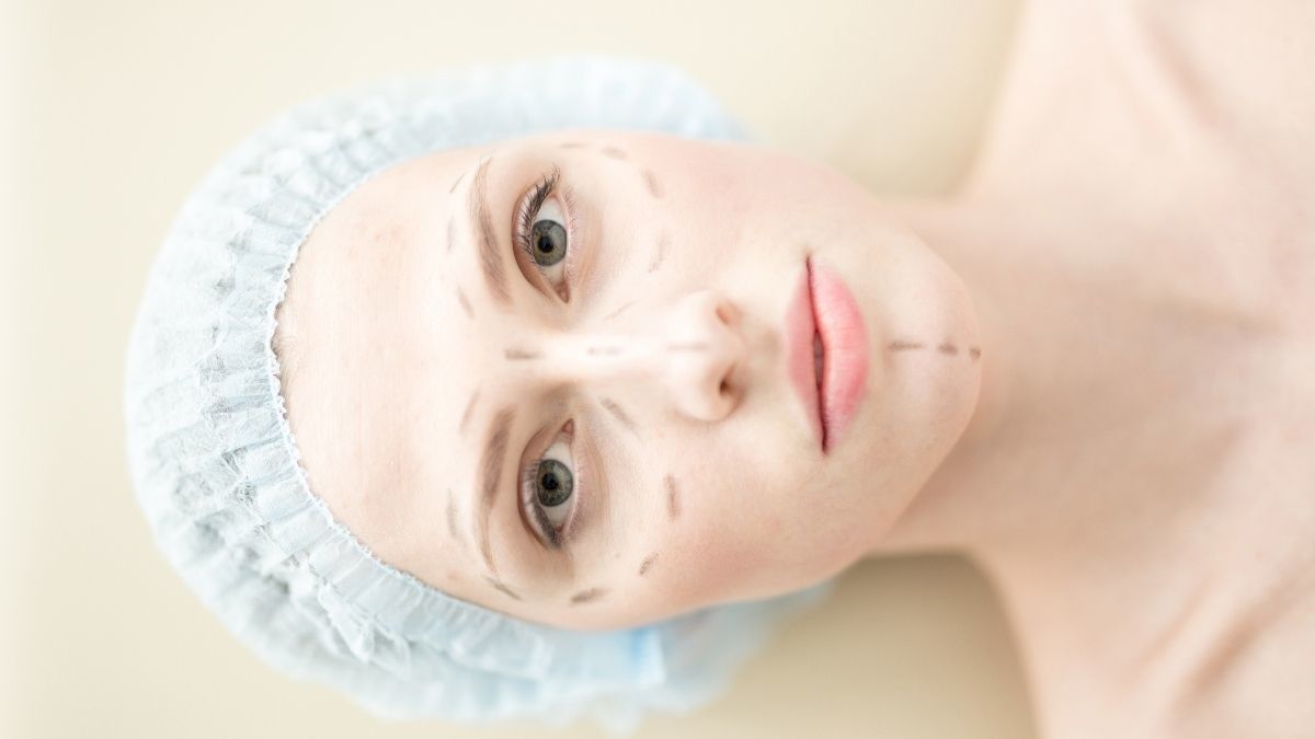 Epicanthoplasty, Operasi Plastik untuk Perbaiki Lipatan Mata