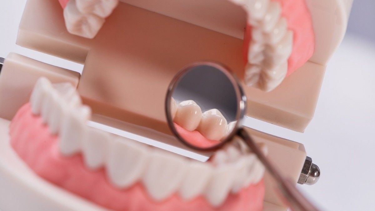 Beberapa Penyebab Gusi Pucat yang Harus Anda Waspadai