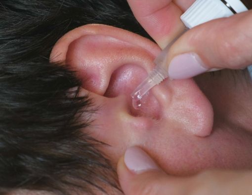 Telinga Berdenging Bisa Diatasi dengan Obat Tetes Telinga?