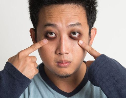 Menghilangkan Mata Panda dengan Mudah