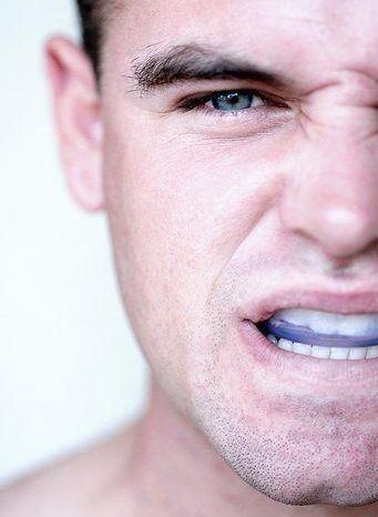 Mouth Guard, Si Pelindung Mulut