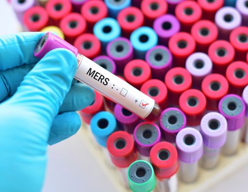 Berkenalan dengan Flu Unta alias MERS