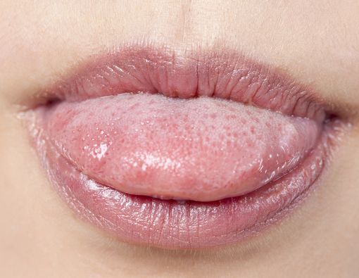 Perhatikan! Ini Cara Cek Kesehatan Lewat Lidah