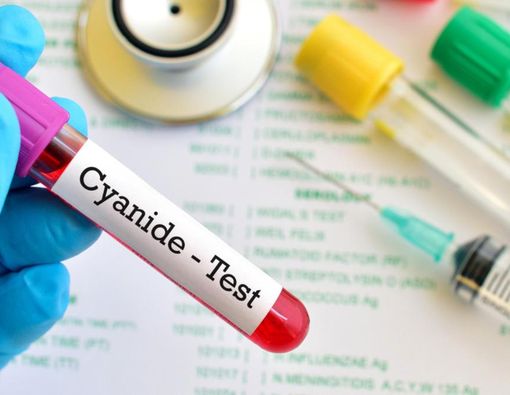 Keracunan Sianida