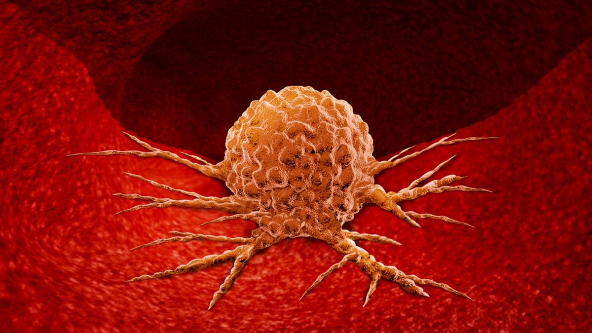 Faktor Penyebab Mimisan yang Berbahaya dan Perlu Diwaspadai - KlikDokter