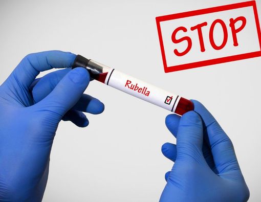 4 Obat Campak Jerman Medis