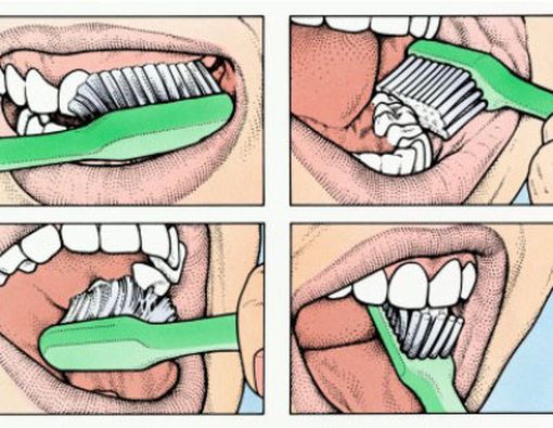 Cara Menyikat Gigi yang Benar