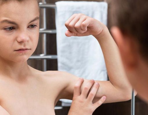 Anak Kurus Belum Tentu Kurang Gizi