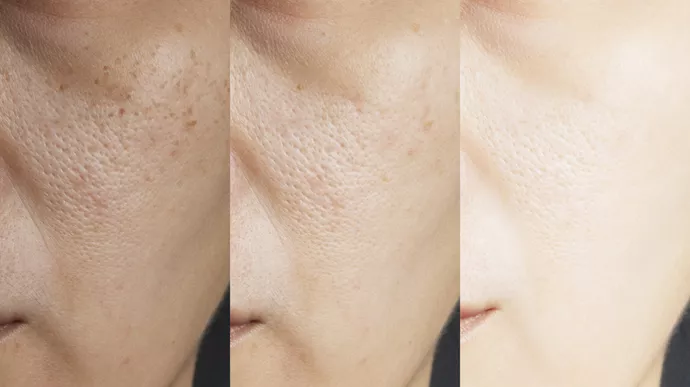 glutathione manfaat untuk wajah 10 bagi Kesehatan Kulit Keunggulan Serum Wajah Glutathione dan