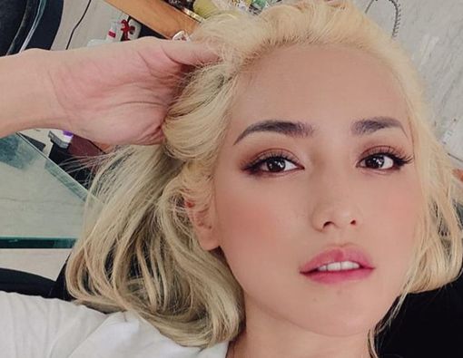 Jessica Iskandar Mengidap Graves Disease Autoimmune, Apa Itu?