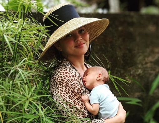 Kenali Gejala Plagiocephaly seperti Anak Chrissy Teigen