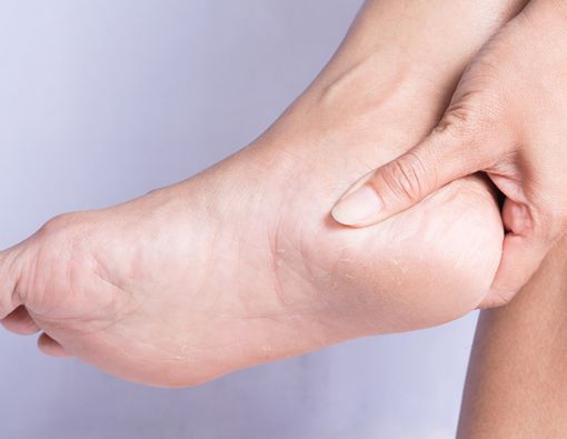 Lewat Kaki, Anda Bisa Mengetahui Masalah pada Tubuh