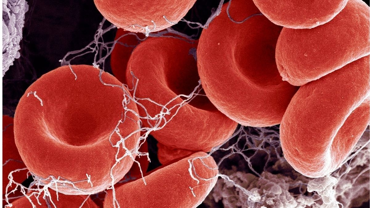 Efek Gangguan Pembekuan Darah pada Tubuh