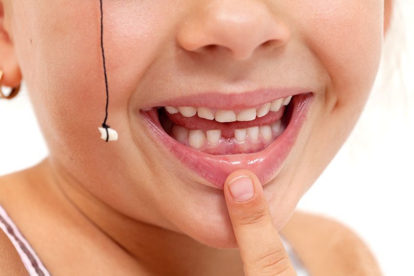 Amankah Mencabut Gigi Anak dengan Benang?