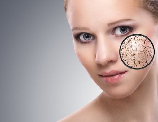 Kenali Penyebab-penyebab Penuaan Dini