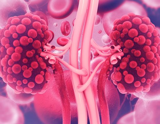 Harus Tahu, Ini 5 Persiapan Operasi Cangkok Ginjal