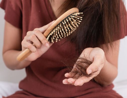 Benarkah Penyakit Lupus Sebabkan Kebotakan Rambut?