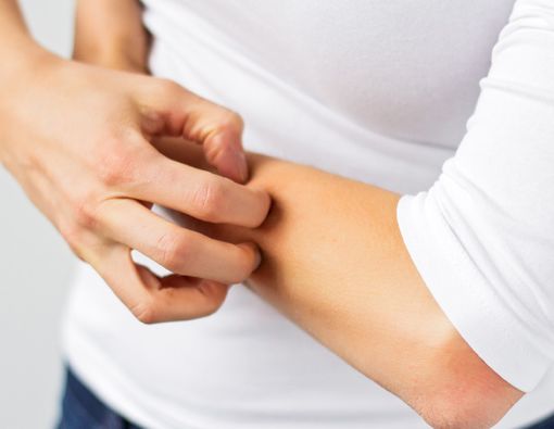 Inilah Gejala Klinis Imunitas Kulit yang Terganggu