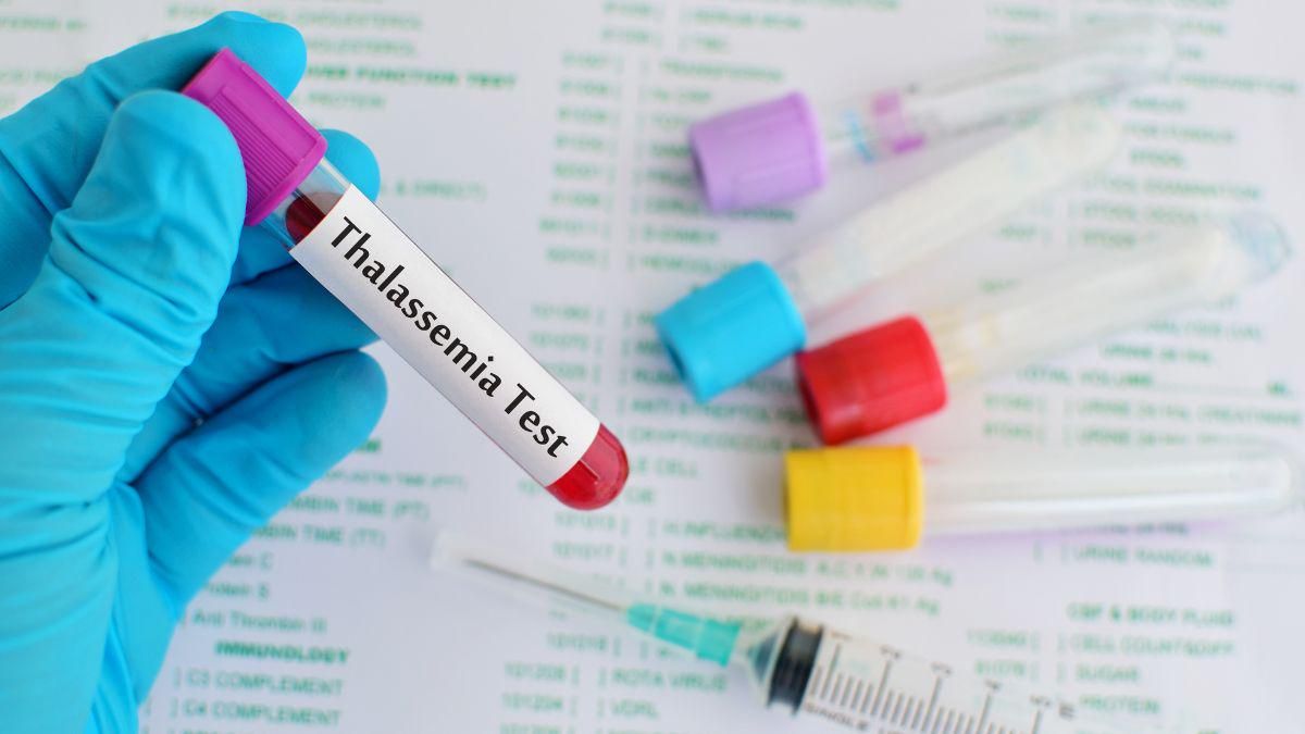 8 Pemeriksaan untuk Diagnosis Talasemia