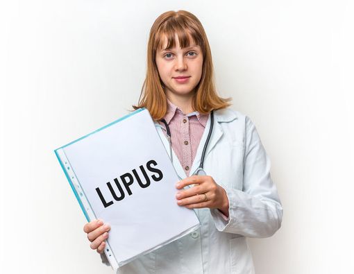 Lupus, Penyakit yang Selalu Mengintai Wanita