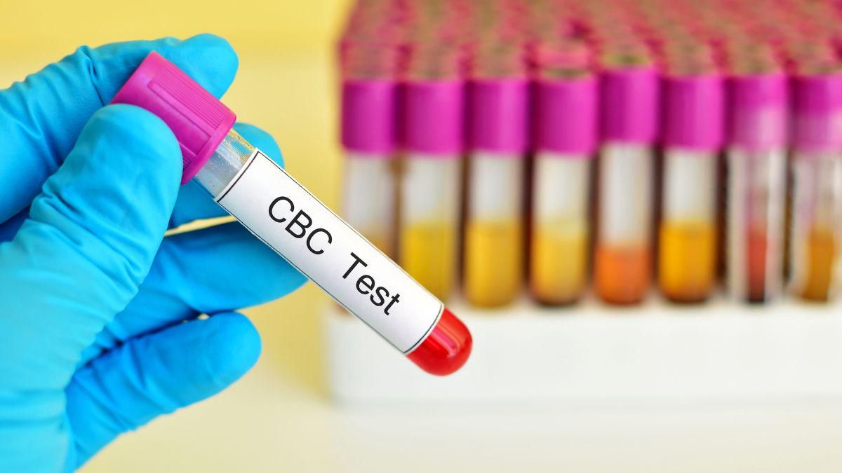 Tes Darah Lengkap (CBC)