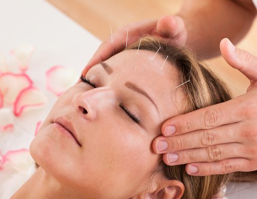 Mana Lebih Efektif Atasi Sakit Kepala, Akupunktur atau Akupresur?