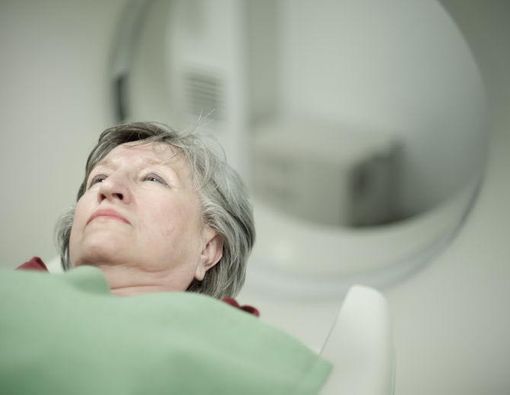 Kenali dan Waspadai Gejala Tumor Otak