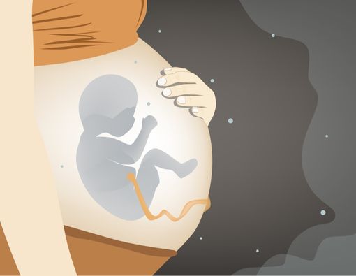 4 Bahaya Ibu Hamil Sering Kena Polusi Udara