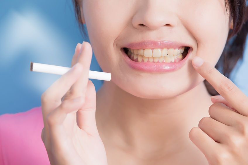 Kiat Menjaga Gigi Tetap Putih bagi Perokok